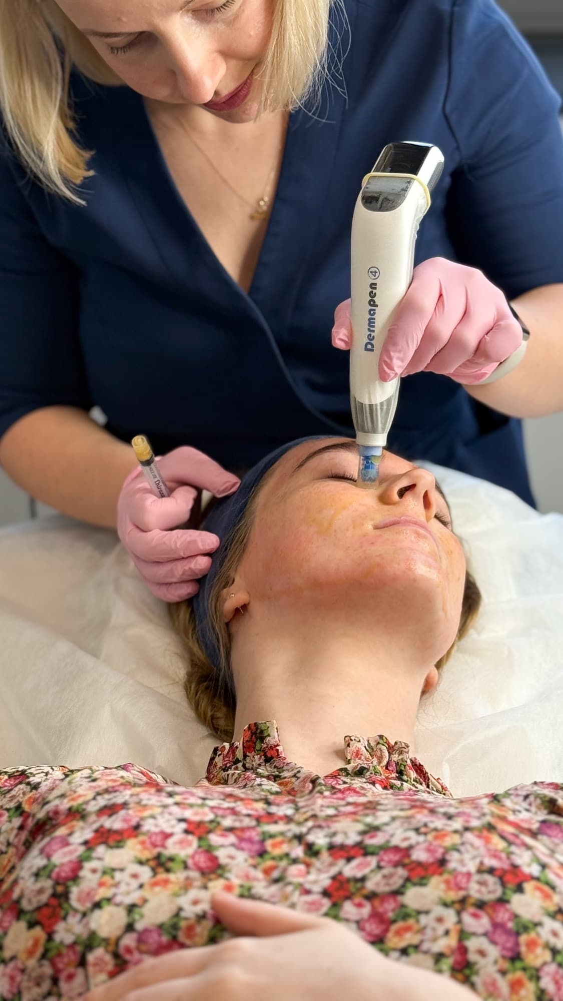 Specjalistka SkyClinic wykonująca zabieg Dermapen u Pacjentki
