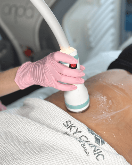 Modelowanie sylwetki Onda w klinice SkyClinic